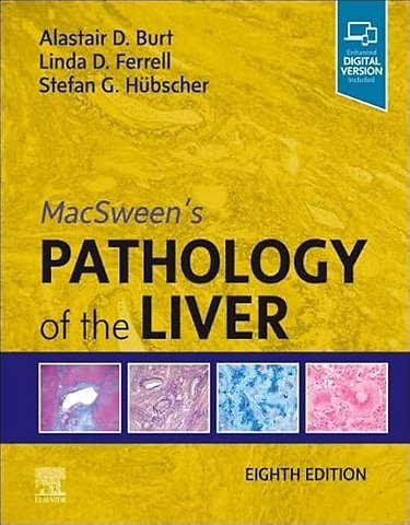 MacSween's Pathology of the Liver