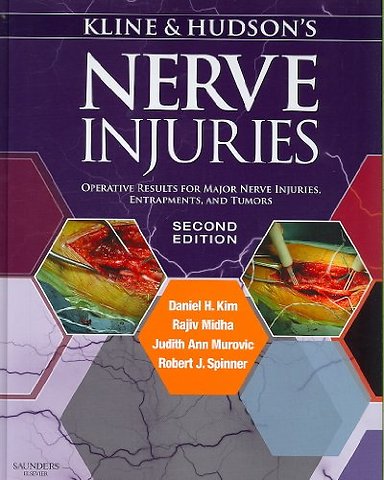 Kline and Hudson's Nerve Injuries