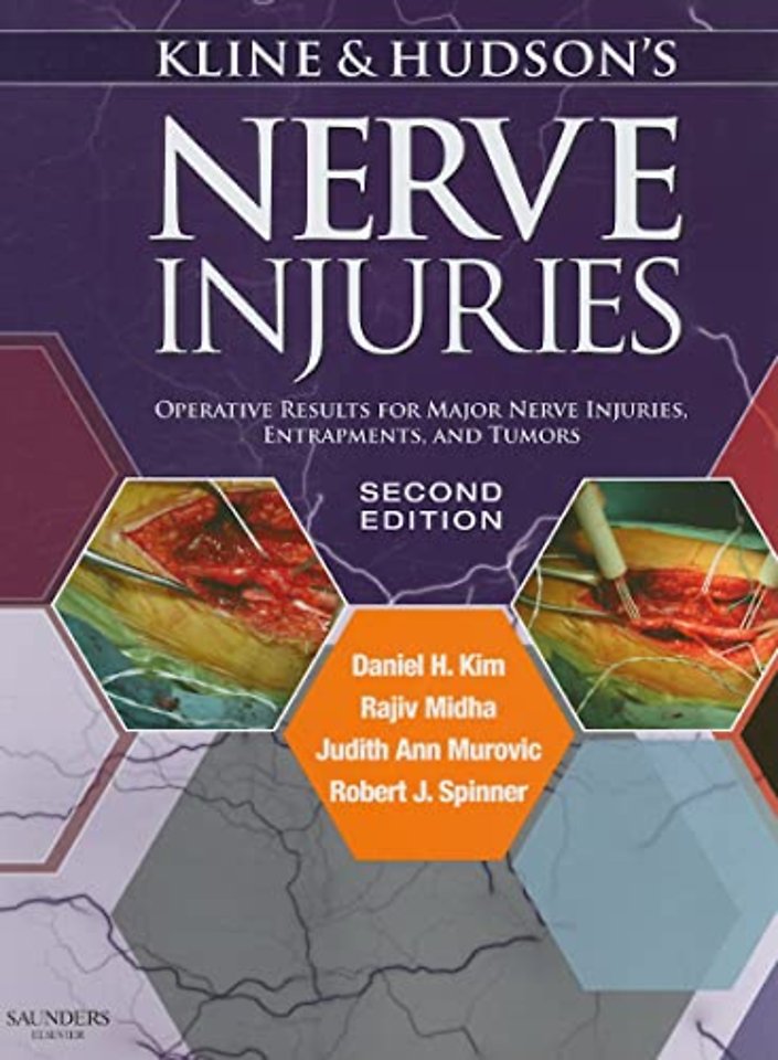Kline and Hudson's Nerve Injuries