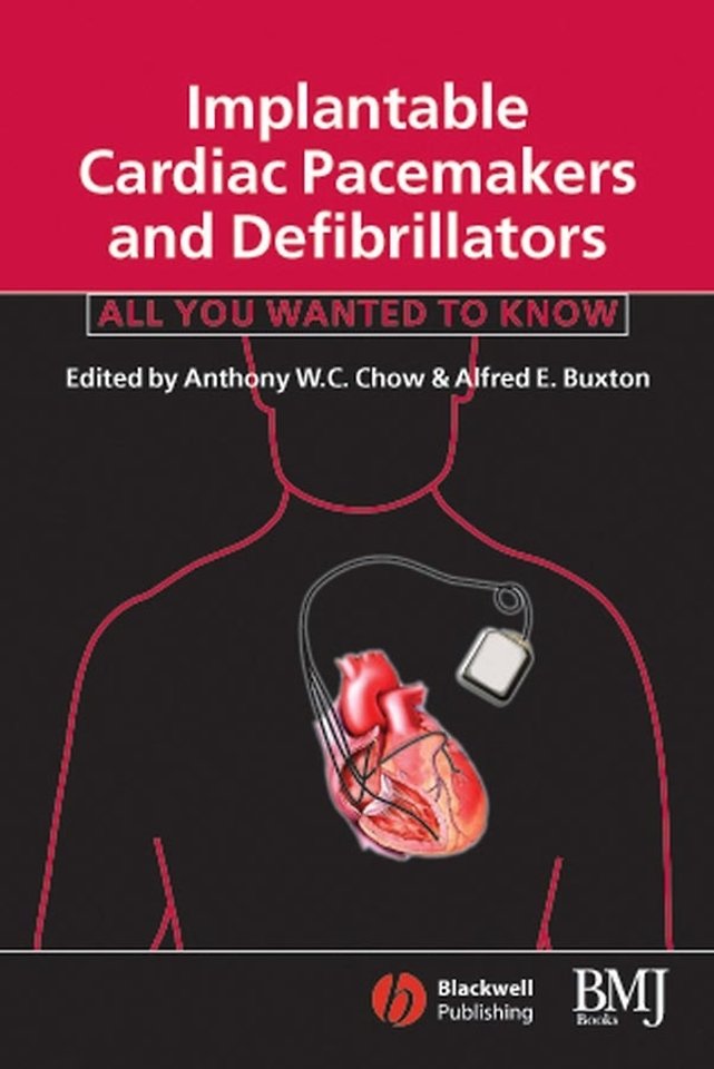 Implantable Cardiac Pacemakers and Defibrillators – All You Wanted to Know