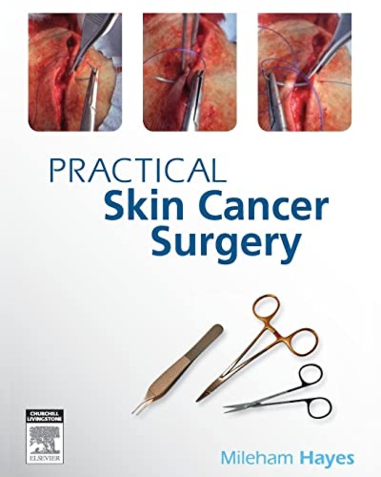 Practical Skin Cancer Surgery
