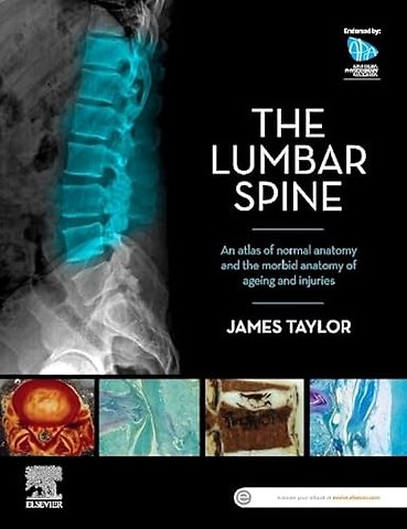 The Lumbar Spine