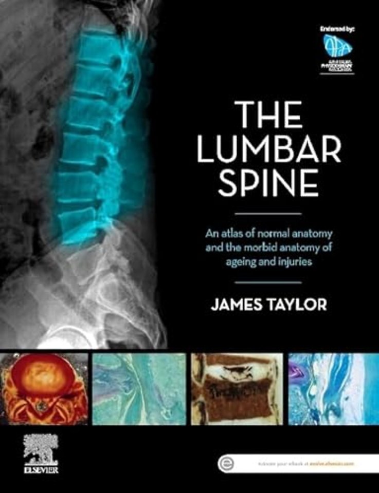 The Lumbar Spine
