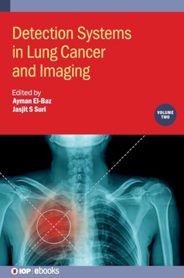 Detection Systems in Lung Cancer and Imaging, Volume 2