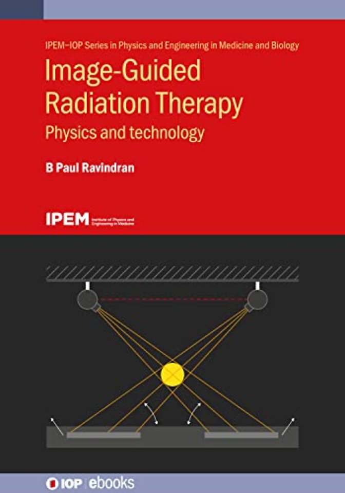 Image-Guided Radiation Therapy