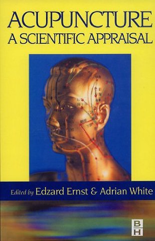 Acupuncture