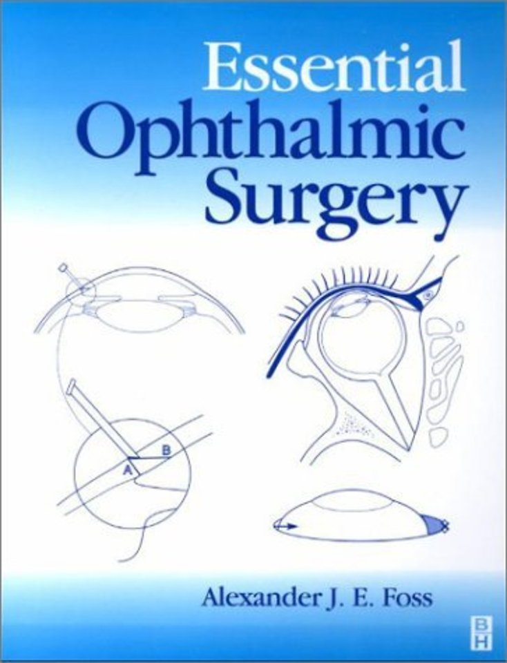 Essential Ophthalmic Surgery