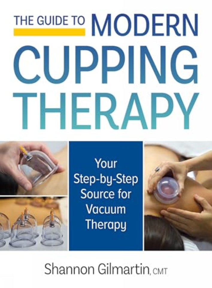 The Guide to Modern Cupping Therapy
