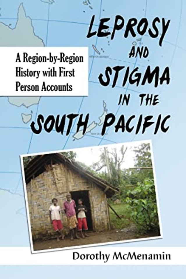 Leprosy and Stigma in the South Pacific