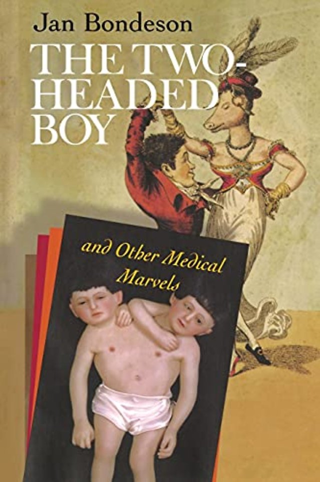 The Two–headed Boy, and Other Medical Marvels