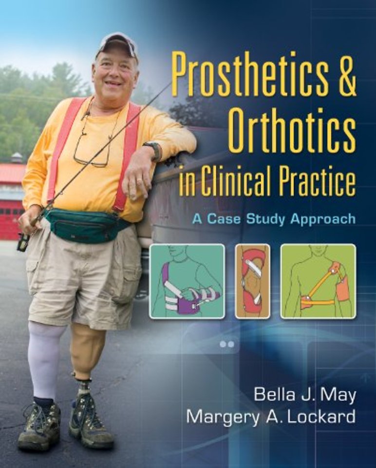 Prosthetics & Orthotics in Clinical Practice – A Case Study Approach