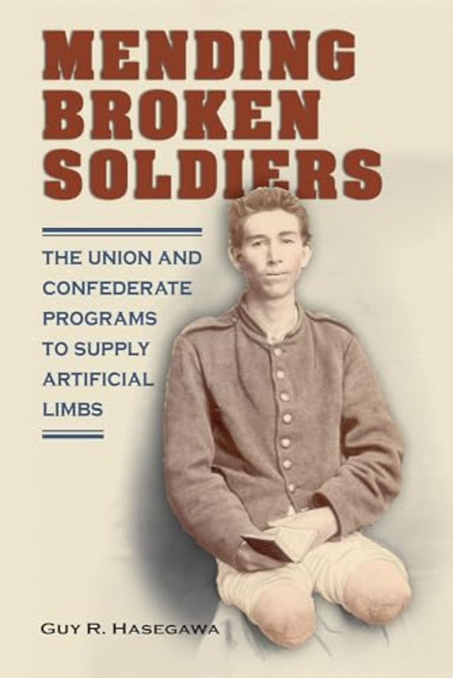 Mending Broken Soldiers – The Union and Confederate Programs to Supply Artificial Limbs