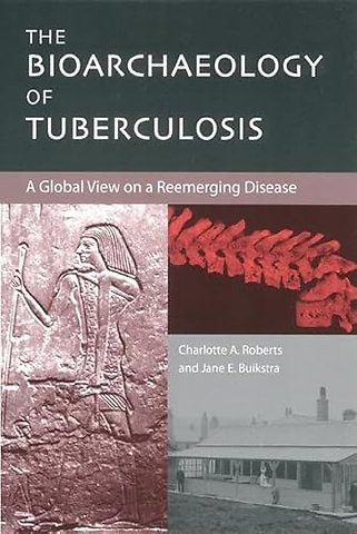 The Bioarchaeology of Tuberculosis – A Global View on a Reemerging Disease