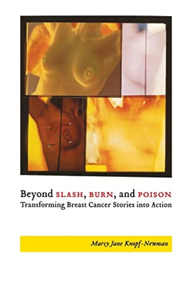 Beyond Slash, Burn, and Poison – Transforming Breast Cancer Stories Into Action