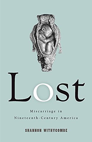 Lost – Miscarriage in Nineteenth–Century America