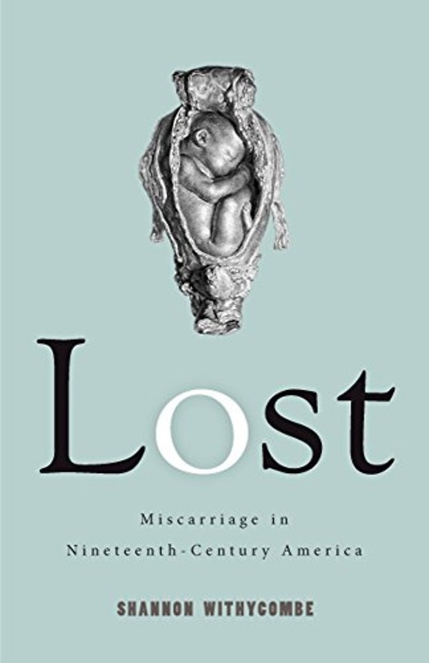 Lost – Miscarriage in Nineteenth–Century America