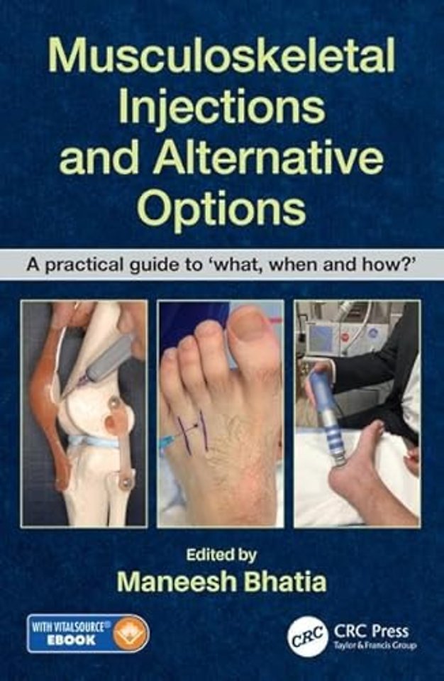 Musculoskeletal Injections and Alternative Options