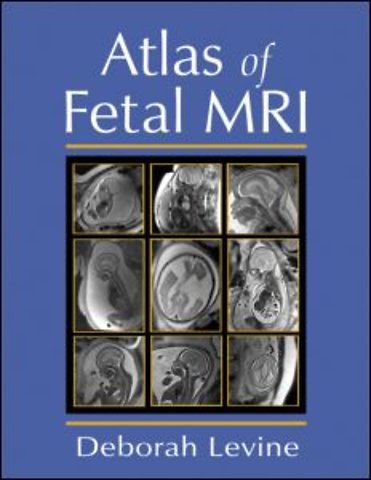 Atlas of Fetal MRI