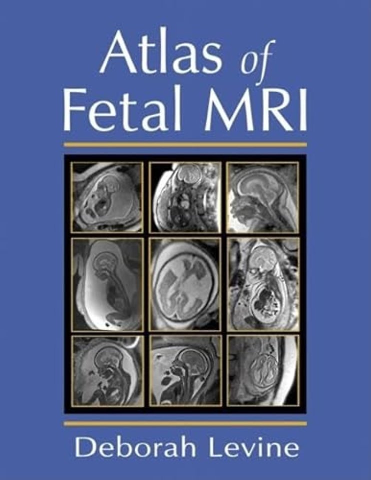 Atlas of Fetal MRI