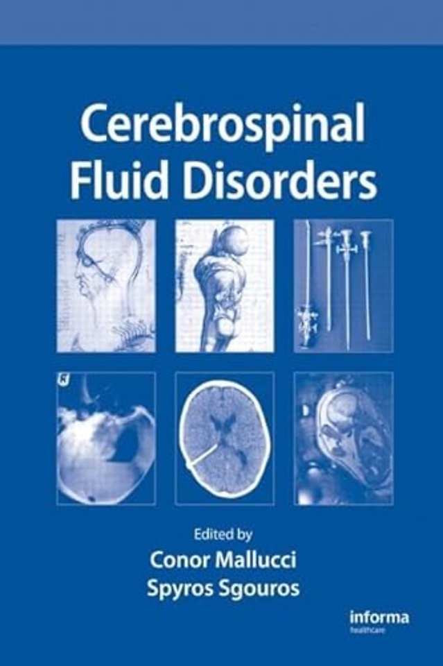 Cerebrospinal Fluid Disorders