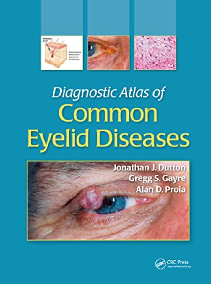 Diagnostic Atlas of Common Eyelid Diseases