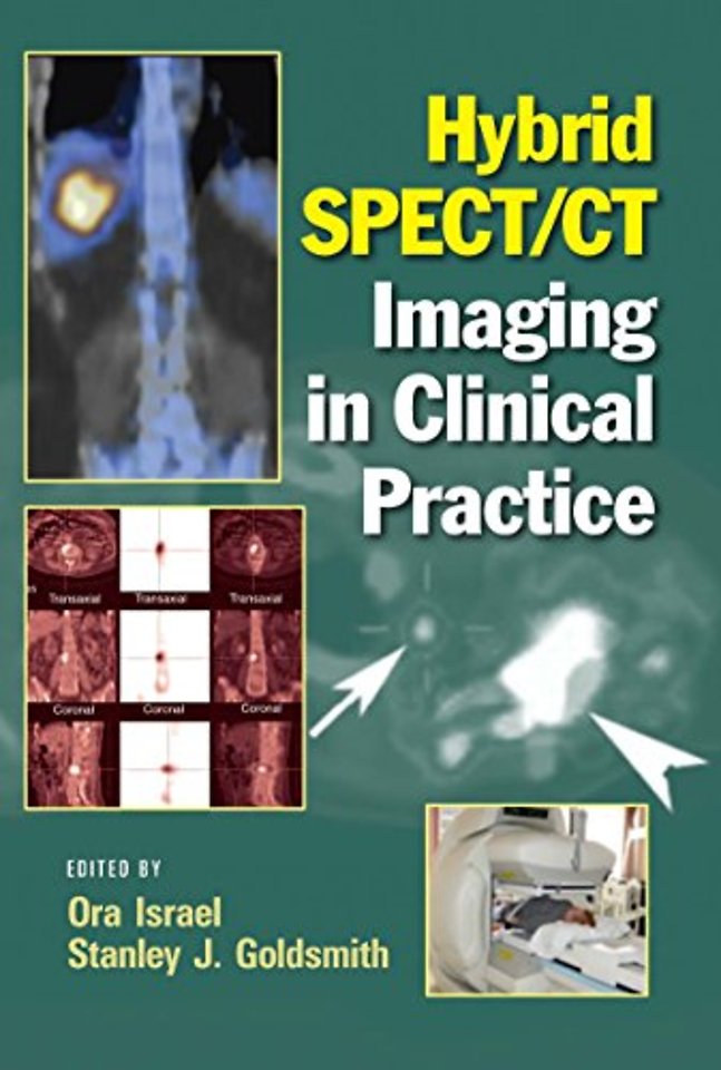 Hybrid SPECT/CT Imaging in Clinical Practice