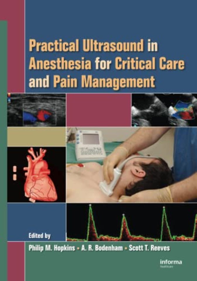 Practical Ultrasound in Anesthesia for Critical Care and Pain Management