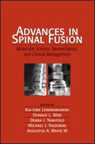 Advances in Spinal Fusion