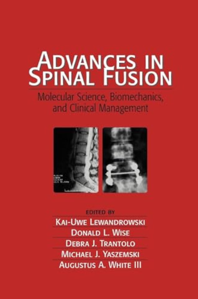 Advances in Spinal Fusion