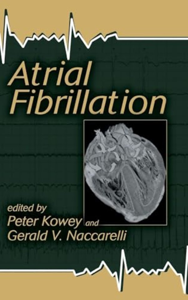 Atrial Fibrillation