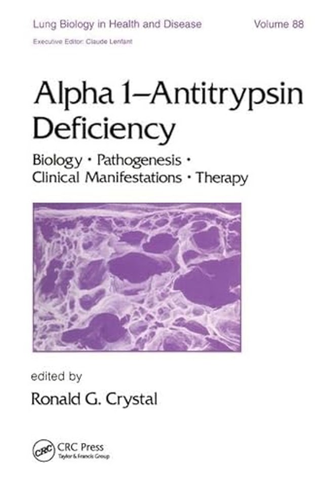 Alpha 1 - Antitrypsin Deficiency