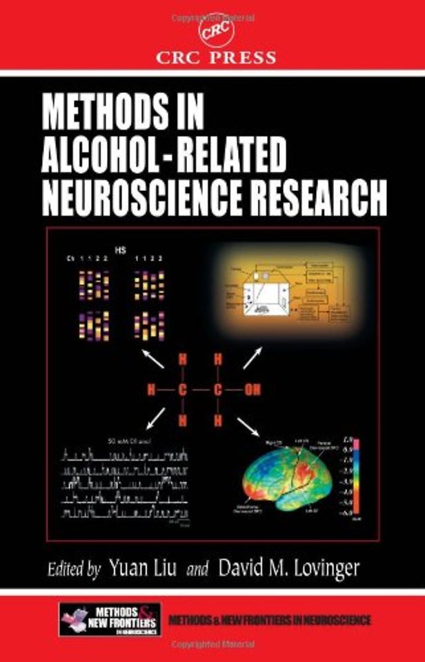 Methods in Alcohol-Related Neuroscience Research