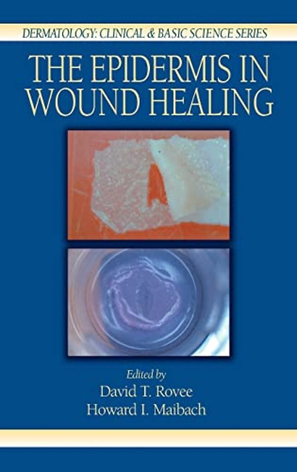 Epidermis in Wound Healing