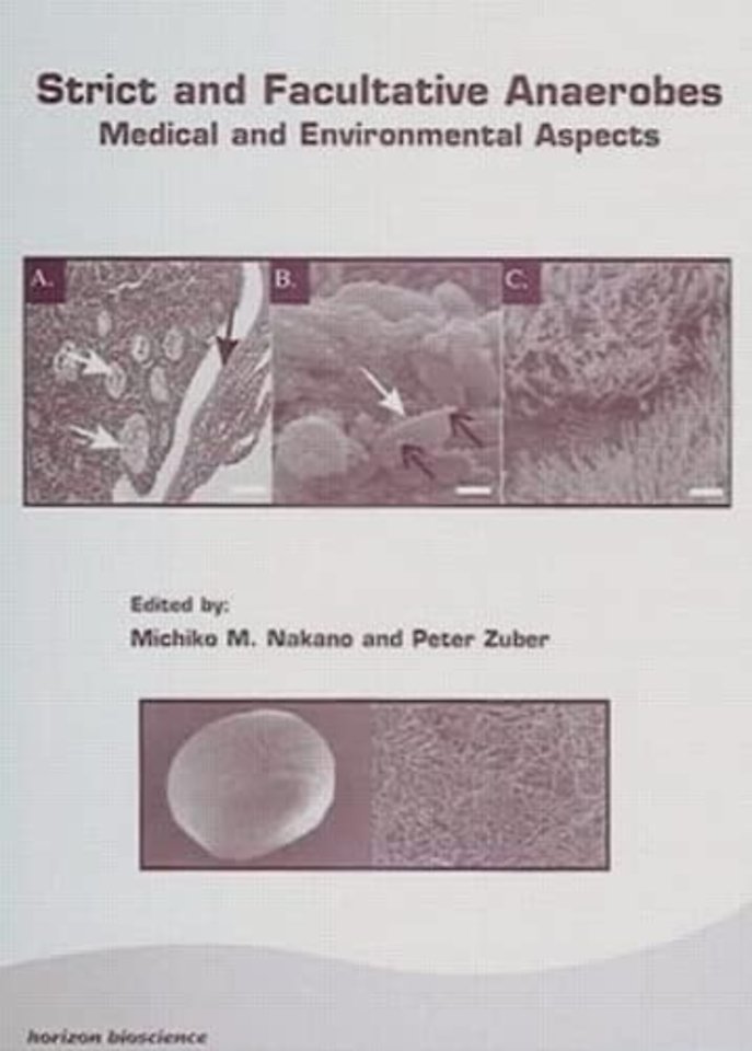 Strict and Facultative Anaerobes