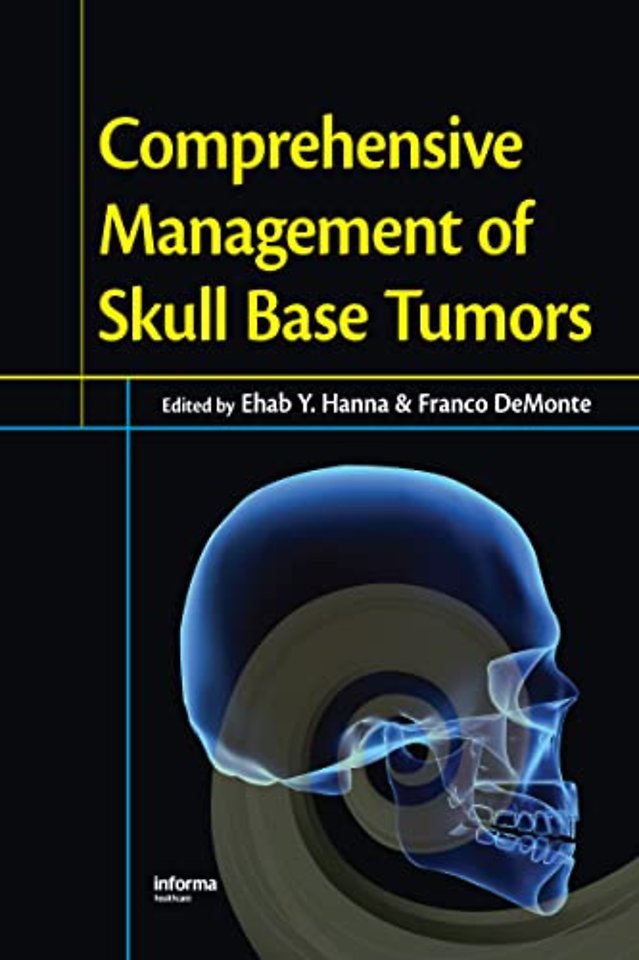 Comprehensive Management of Skull Base Tumors