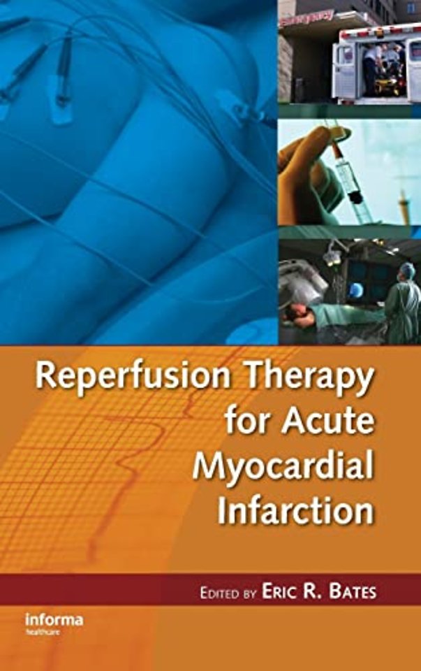 Reperfusion Therapy for Acute Myocardial Infarction