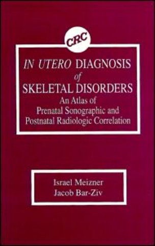 In Utero Diagnosis of Skeletal Disorders An Atlas of Prenatal Sonographic and Postnatal Radiologic Correlation