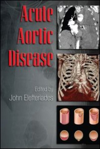 Acute Aortic Disease