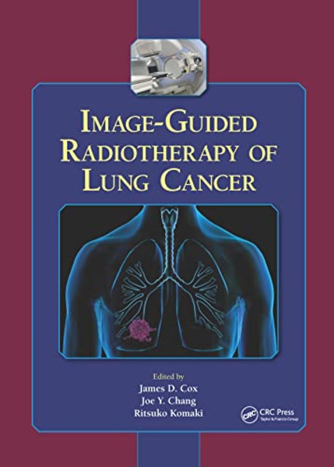 Image-Guided Radiotherapy of Lung Cancer