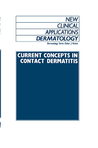 Current Concepts in Contact Dermatitis