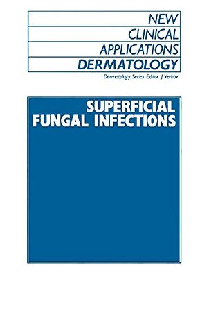 Superficial Fungal Infections