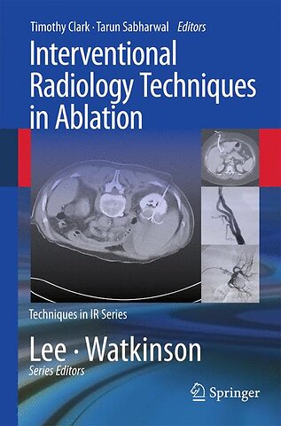 Interventional Radiology Techniques in Ablation