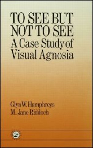 To See But Not To See: A Case Study Of Visual Agnosia