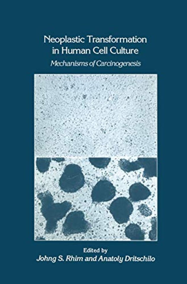 Neoplastic Transformation in Human Cell Culture