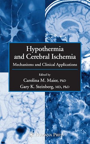 Hypothermia and Cerebral Ischemia