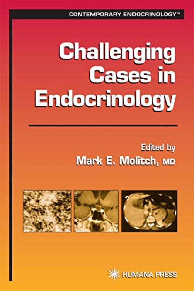 Challenging Cases in Endocrinology