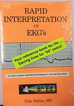 Rapid Interpretation Of Ekg'S