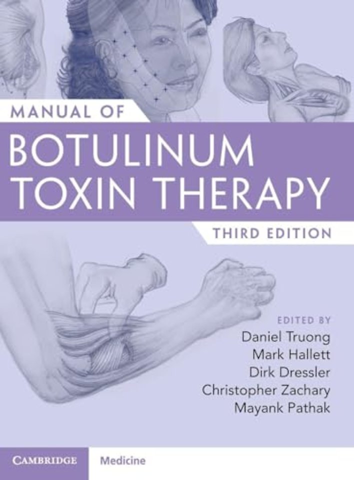 Manual of Botulinum Toxin Therapy