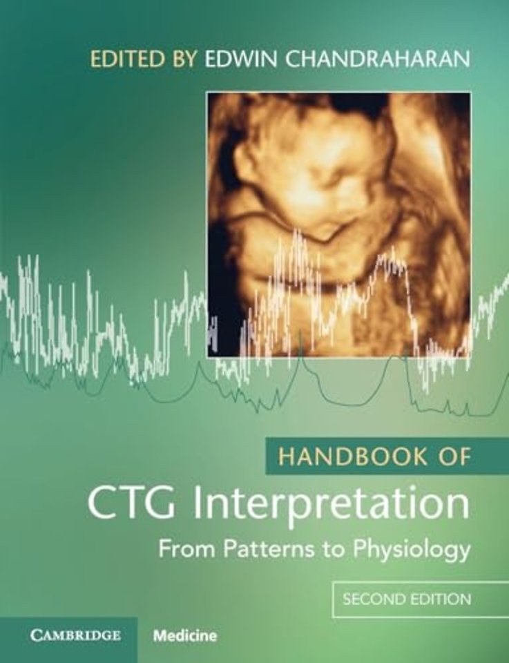 Handbook of CTG Interpretation