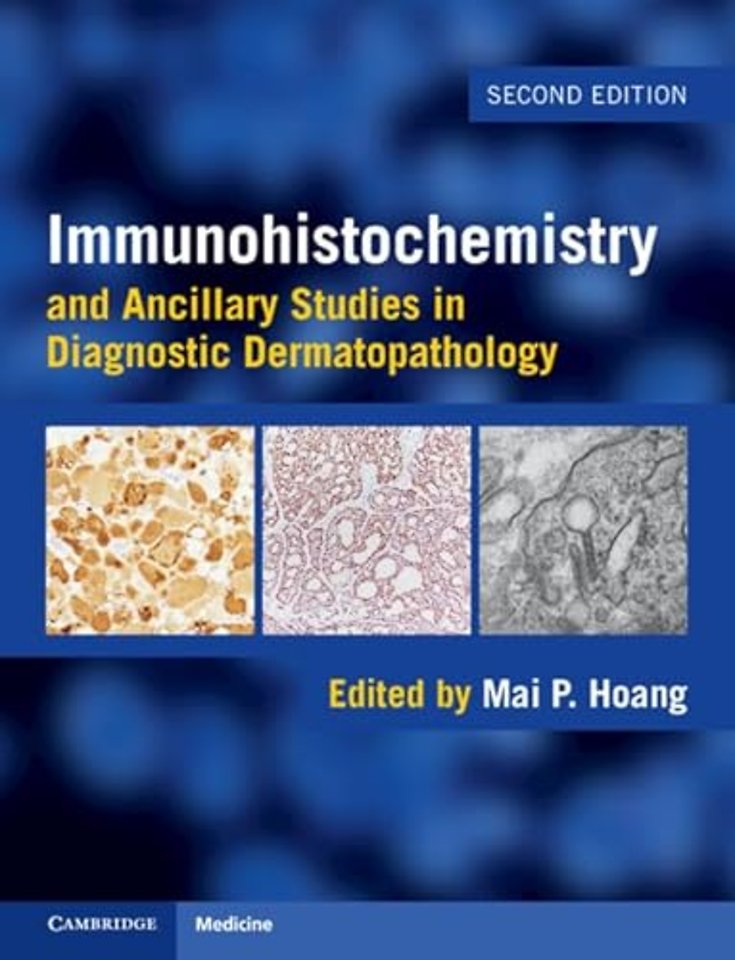 Immunohistochemistry and Ancillary Studies in Diagnostic Dermatopathology